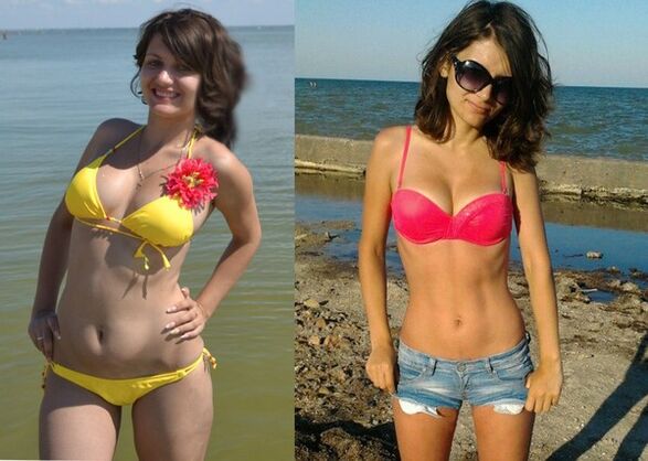 Anna a perdu 10 kg avec NexaSlim